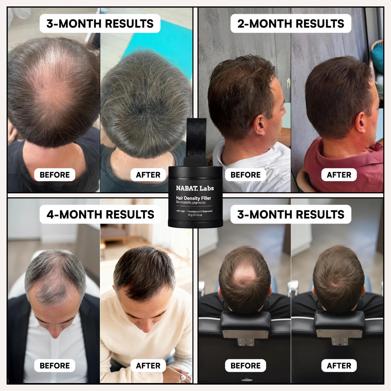 Hair Restoration System